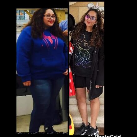 Yo-Yo dieting before and after